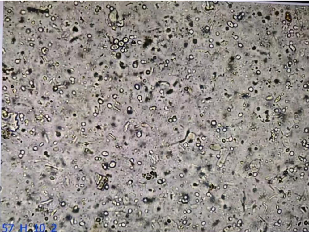 粪便常规仪器怎么用粪便中的繁星点点_https://www.jmylbn.com_新闻资讯_第4张