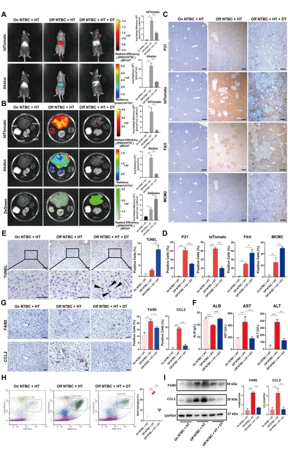 建立的p21-atd小鼠模型可用于同时监测,分选和清除体内的p21 衰老细胞
