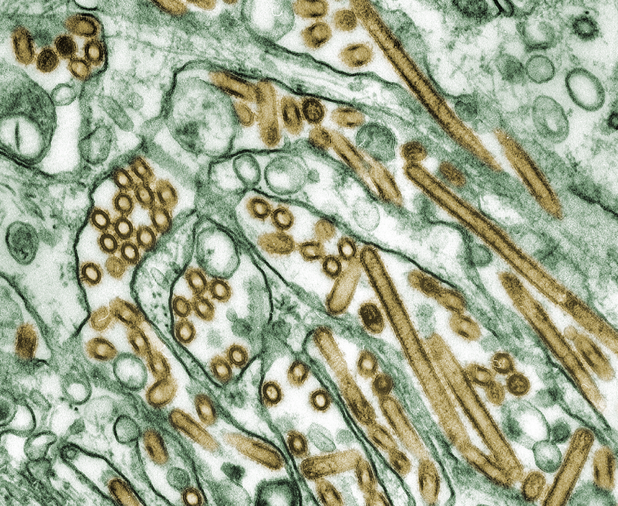 美国得州一名男子感染h5n1高致病性禽流感,系首例牛传人病例 | 环球