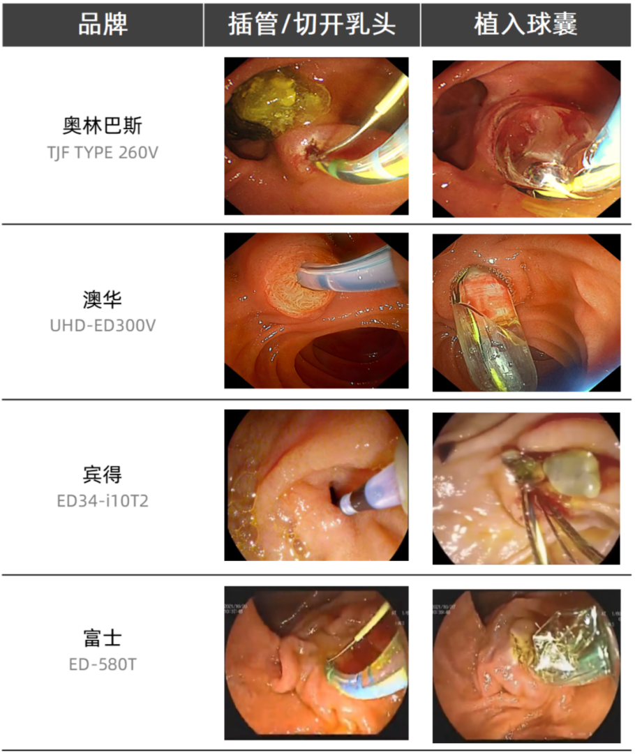 而从制造难度来看,虽然十二指肠镜的头端因为加入抬钳器和保持镜头