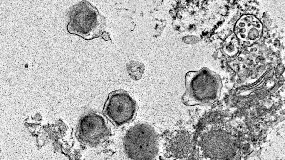 科学家在海洋中发现数百种潜伏的神秘巨型病毒_腾讯新闻
