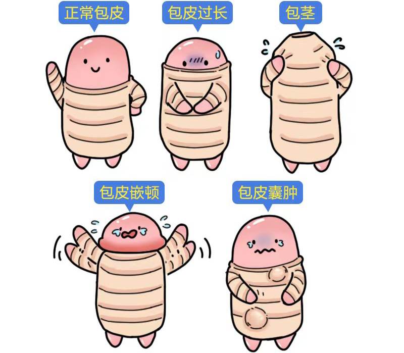 25岁未恋！包皮嵌顿该手术？医生警告吓懵，这咋整