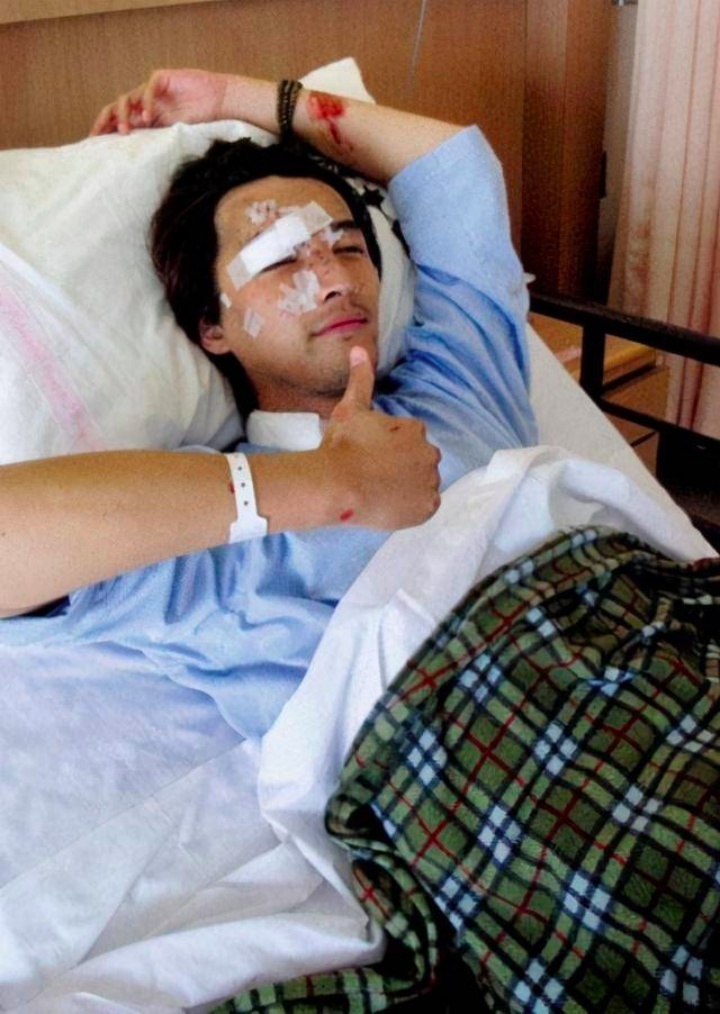 胡歌晒右眼伤疤回忆17年前车祸,称对不起好多人,此前女助手在车祸中