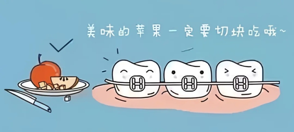 给你的牙齿"改斜归正"!盘点矫牙过程常见问题