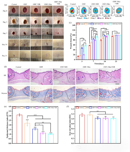 伤口酸是怎么回事《Mater. Today Bio》暨南大学李立华： 透明质酸水凝胶pH响应释放二甲双胍促进糖尿病感染伤口愈合！_https://www.jmylbn.com_新闻资讯_第4张