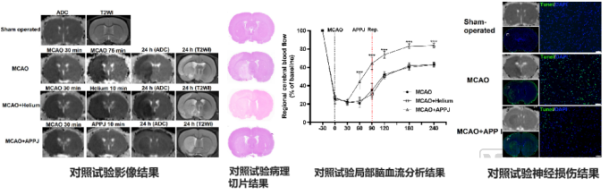 什么是等离子治疗仪北卓医疗：构筑“一体两翼”跨模态智联闭环生态，占据中国神经科学数智化浪潮先发身位_https://www.jmylbn.com_新闻资讯_第9张