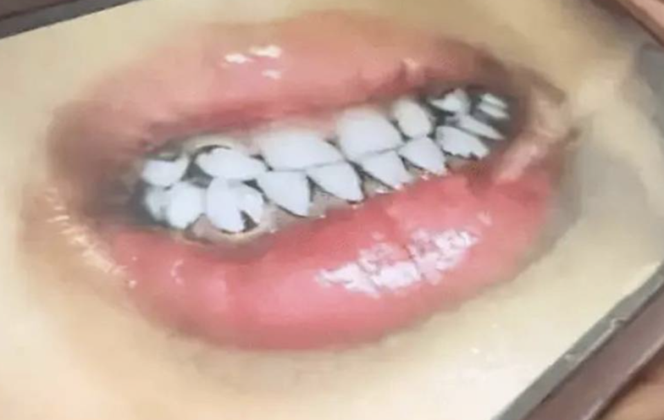 血铅异常患儿赴上海就医,牙龈已现铅线!日常生活中有哪些"含铅"隐患?