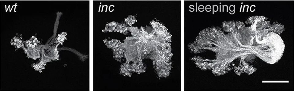 以色列医疗设备有哪些追问weekly ｜ 过去一周，脑科学领域有哪些新发现？Vol.63_https://www.jmylbn.com_新闻资讯_第19张