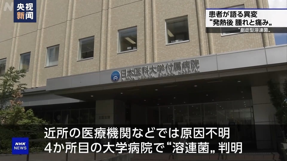 日本今年链球菌中毒休克综合征病例数激增