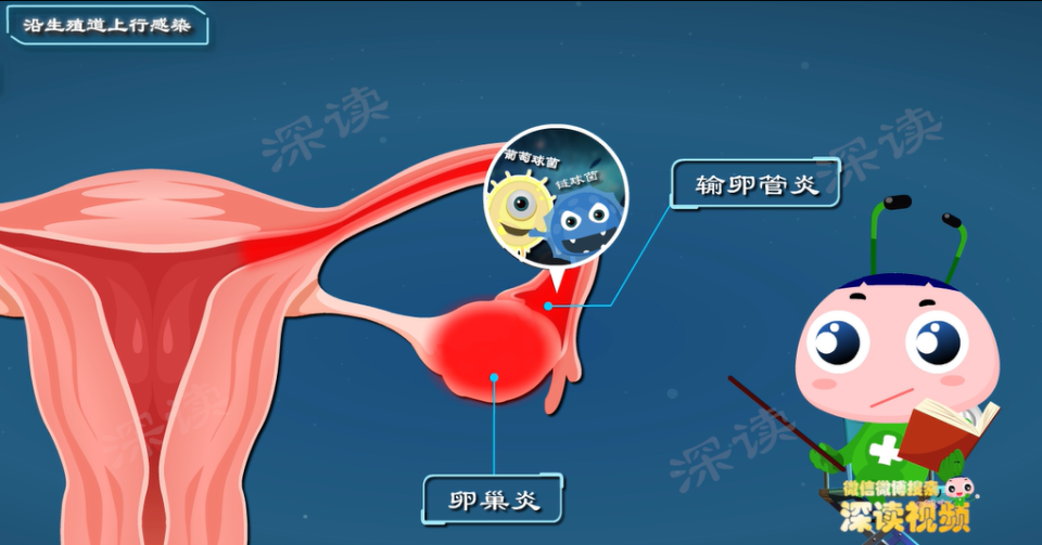 卵巢和输卵管位置图片图片