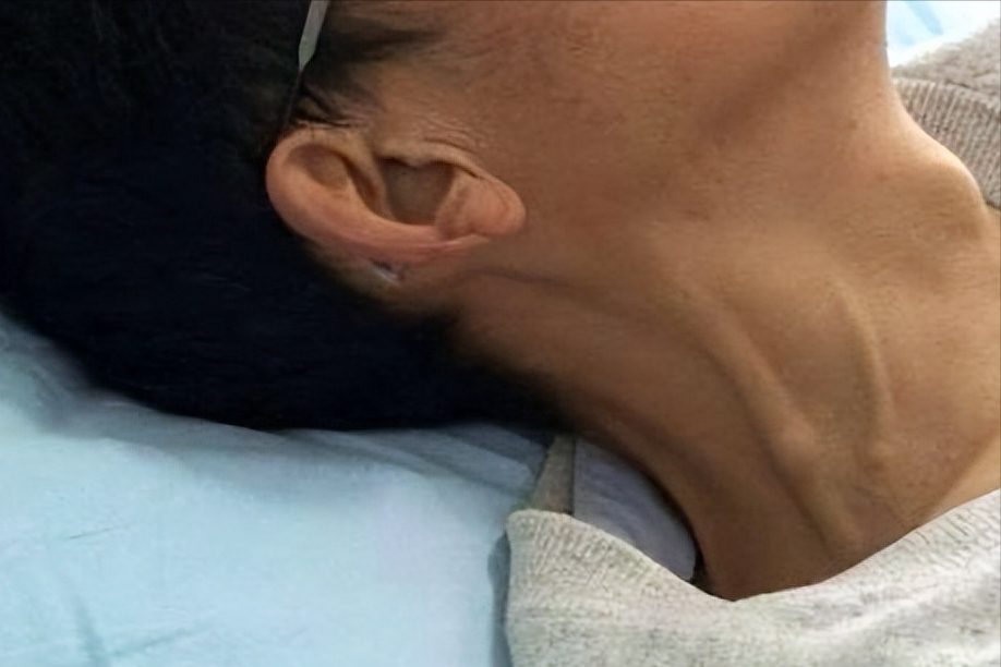 多吃这几种食物,或有效避免脖子变粗血管变堵_腾讯新闻