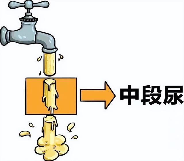 尿常规——了解尿液中的小秘密