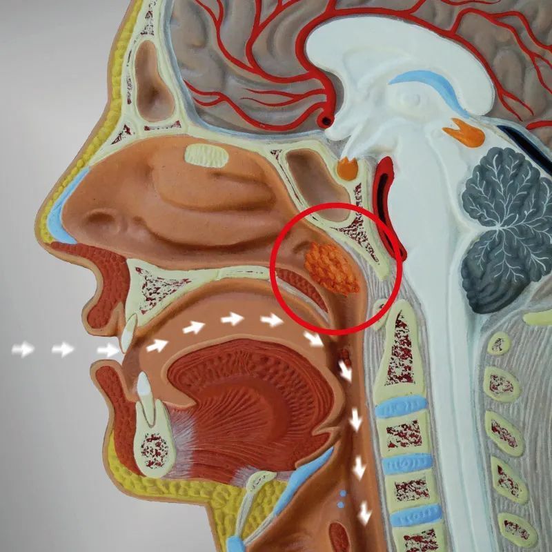 孩子腺样体肥大还嘴突,该手术还是该矫牙?