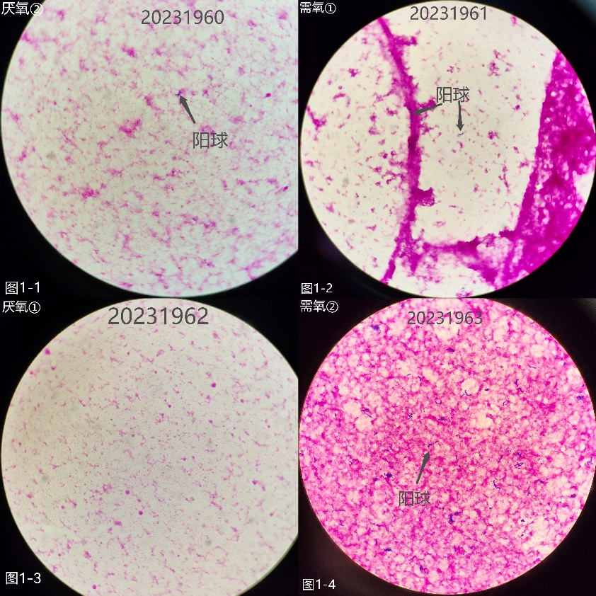 这张油镜视野中的菌量比前两张涂片更多.