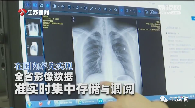 拍片机怎么用有了这个平台，看病“拍片”更轻松！_https://www.jmylbn.com_新闻资讯_第3张