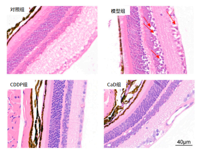 如图1所示,cddp可以显著改善dr小鼠视网膜细胞排列紊乱情况,提示cddp