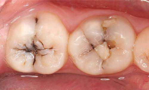 小洞不补,大洞吃苦丨贤医健康说