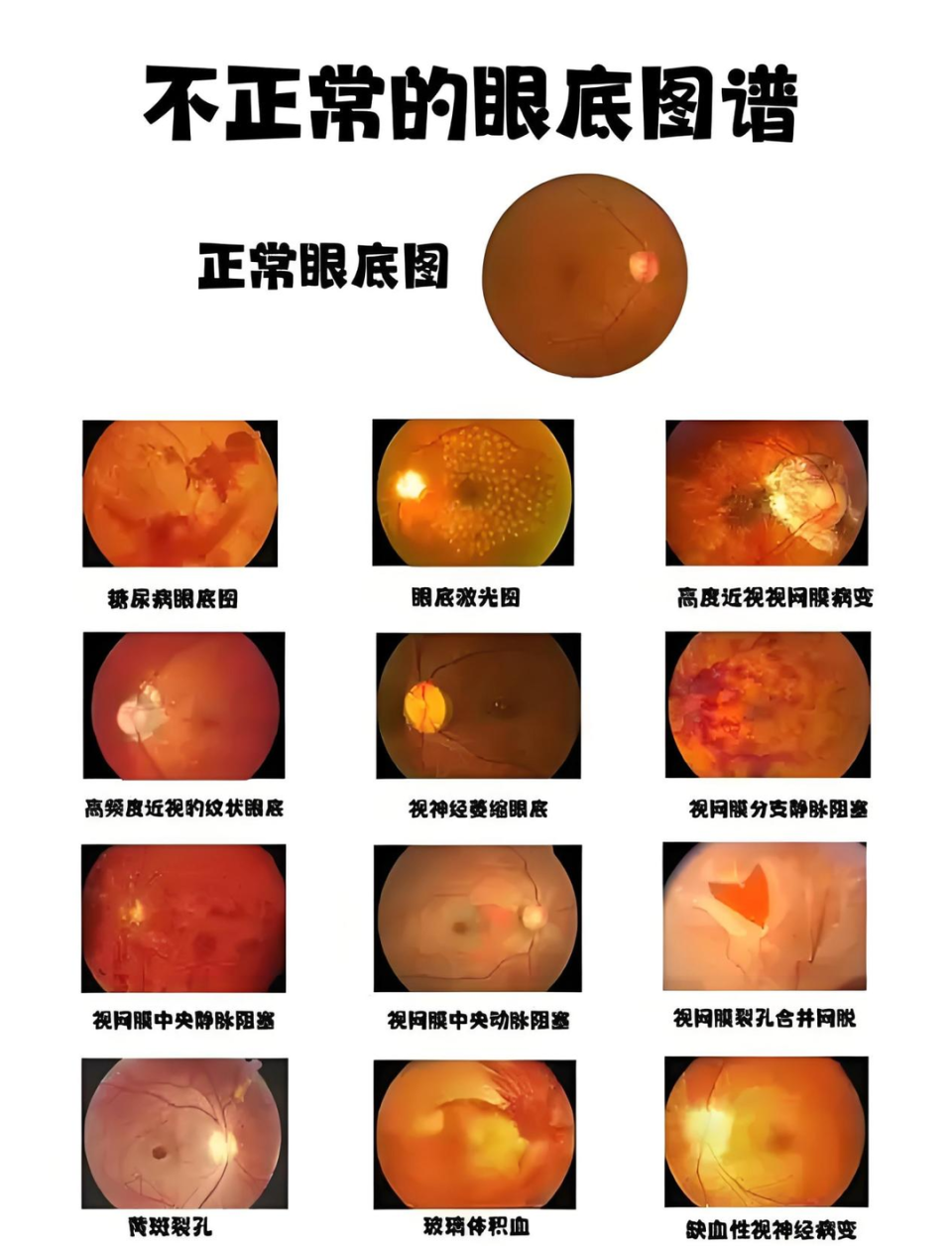 医声医事|眼底一“照”能预测疾病风险！山东省慢性病医院专家解读人工智能照相“黑科技”-腾讯新闻