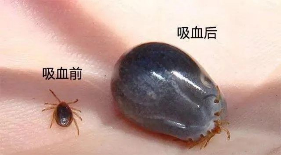 蜱虫叮咬严重时可致死,户外活动要注意