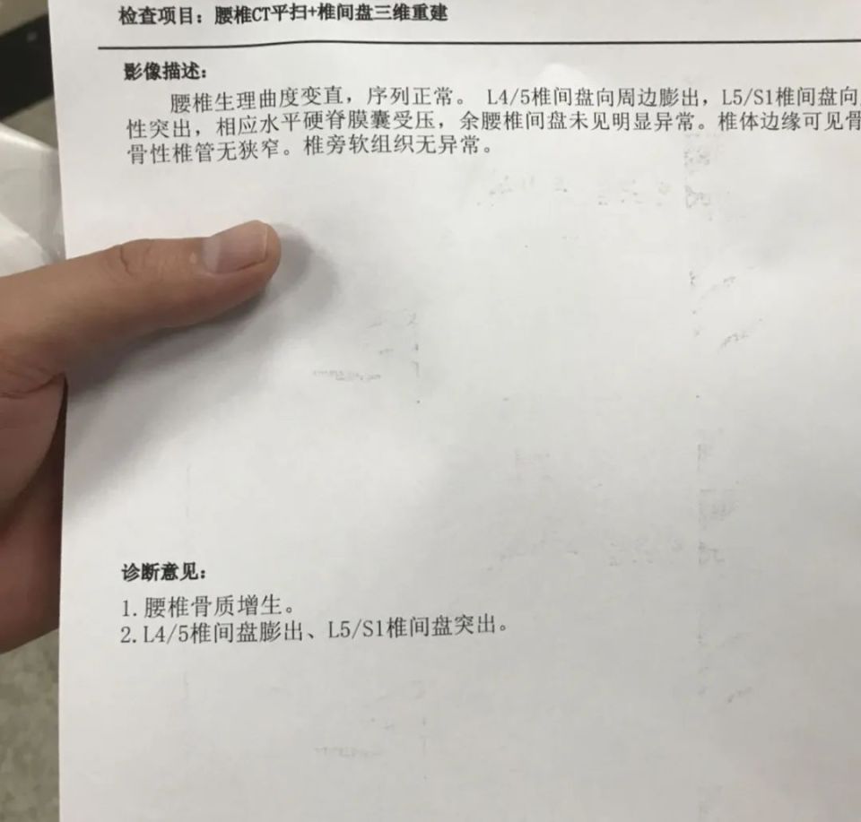 腰间盘突出ct片教程图片