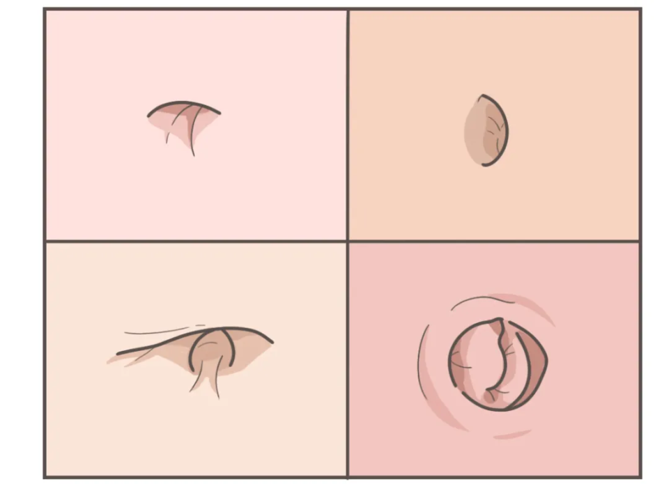 ͼƬ