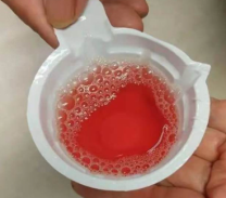 进食某些药物:酚酞片,利福平;(本文第一个例子便是进食红心火龙果后