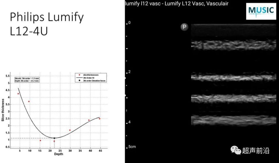 ge医疗器械怎么样GE vs 飞利浦 vs Butterfly ： 手持超声参数差异对比_https://www.jmylbn.com_新闻资讯_第9张