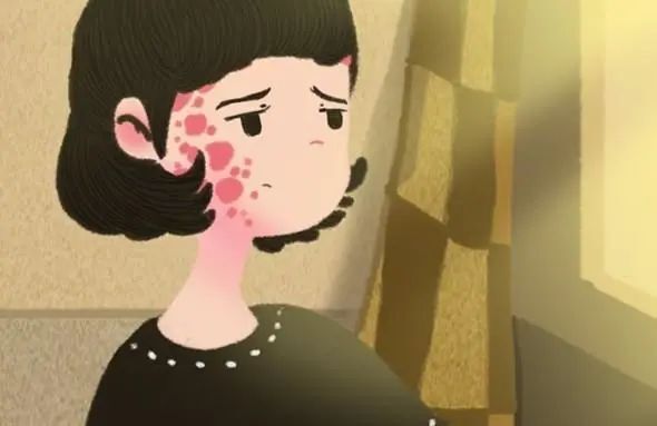 鲍温病的诱发因素但若在鲍温病的斑块上出现溃疡,意味着可能已经发展