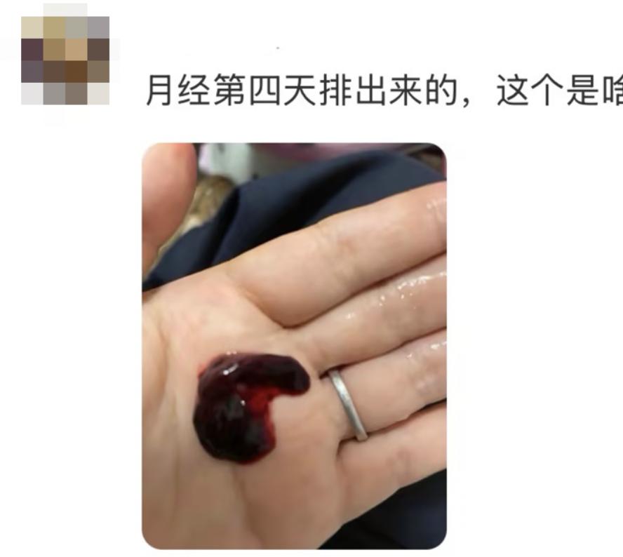 月经有一坨一坨的血块怎么回事_月经有一坨一坨的血块怎么回事图片