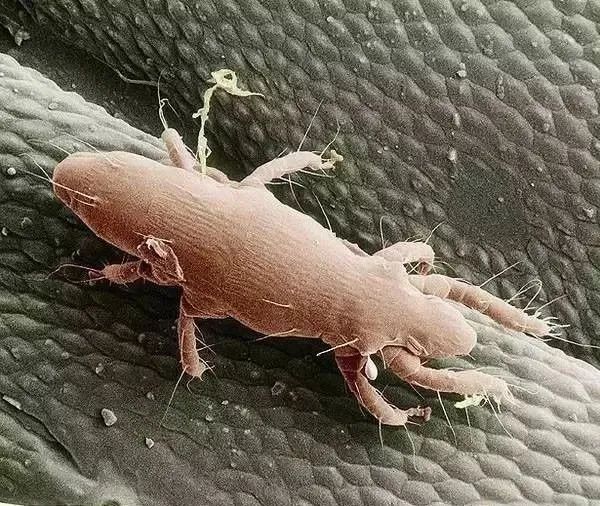 你们要的寄生虫大全来啦!看完不要打我!