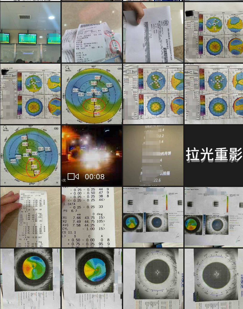 深度｜近视手术“失败”之后-腾讯新闻