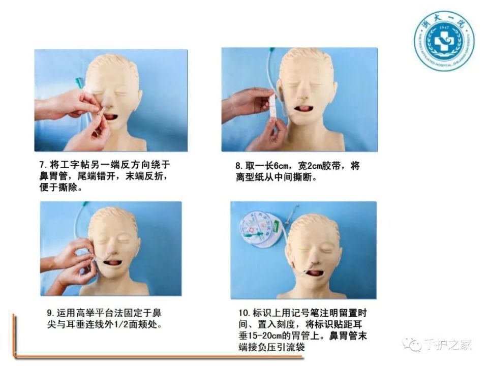 胃管双耳挂绳固定方法图片