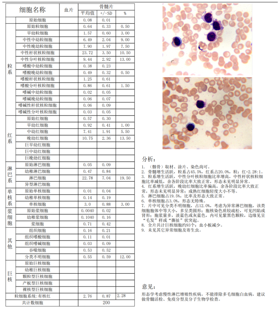 血细胞分析散点图解读图片