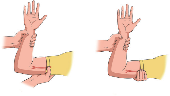 周末说健康|应对创伤,必学的止血法