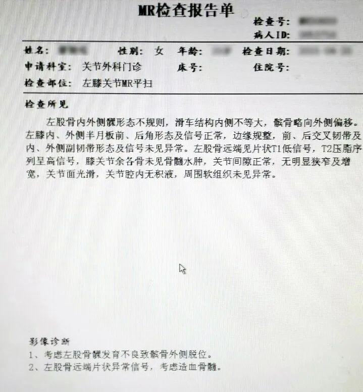 膝关节ct报告模板图片