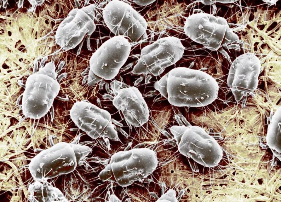 人与螨虫的不解之缘