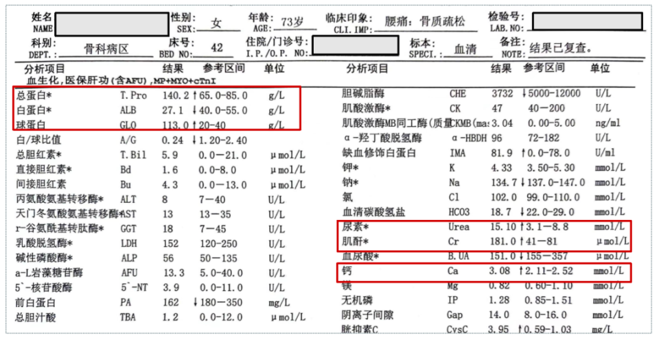 球蛋白偏高图片