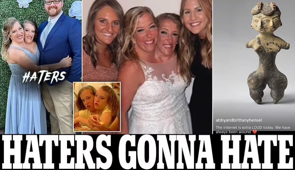 美国连体姐妹之一和男护士结婚,公开婚纱照却遭质疑,发视频回应