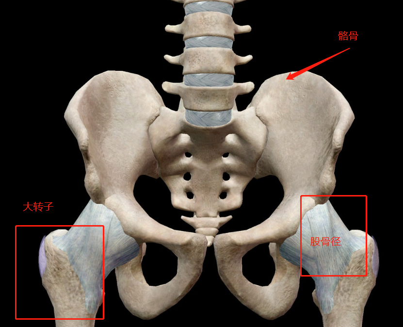 比如骼骨较宽,股骨径较长,大转子也较为突出的盆骨,天生就容易发展成