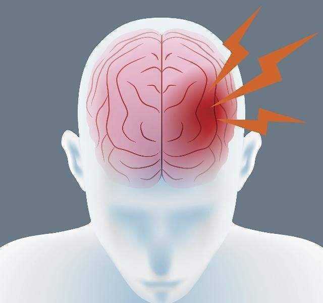 神经头痛怎么治_神经性偏头痛怎么治_血管性神经头痛特效药