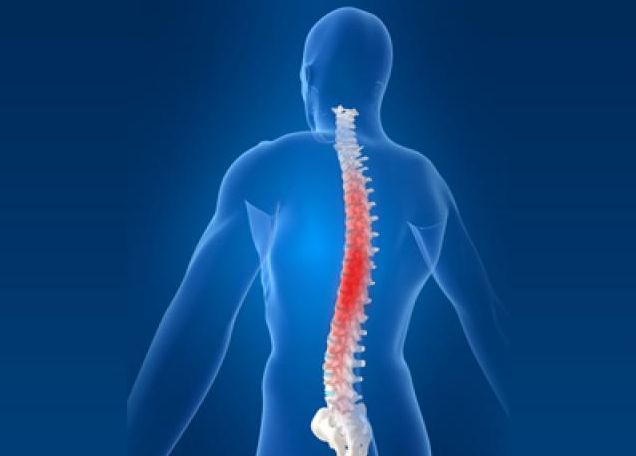 强直性脊柱炎治疗的"双保险"策略