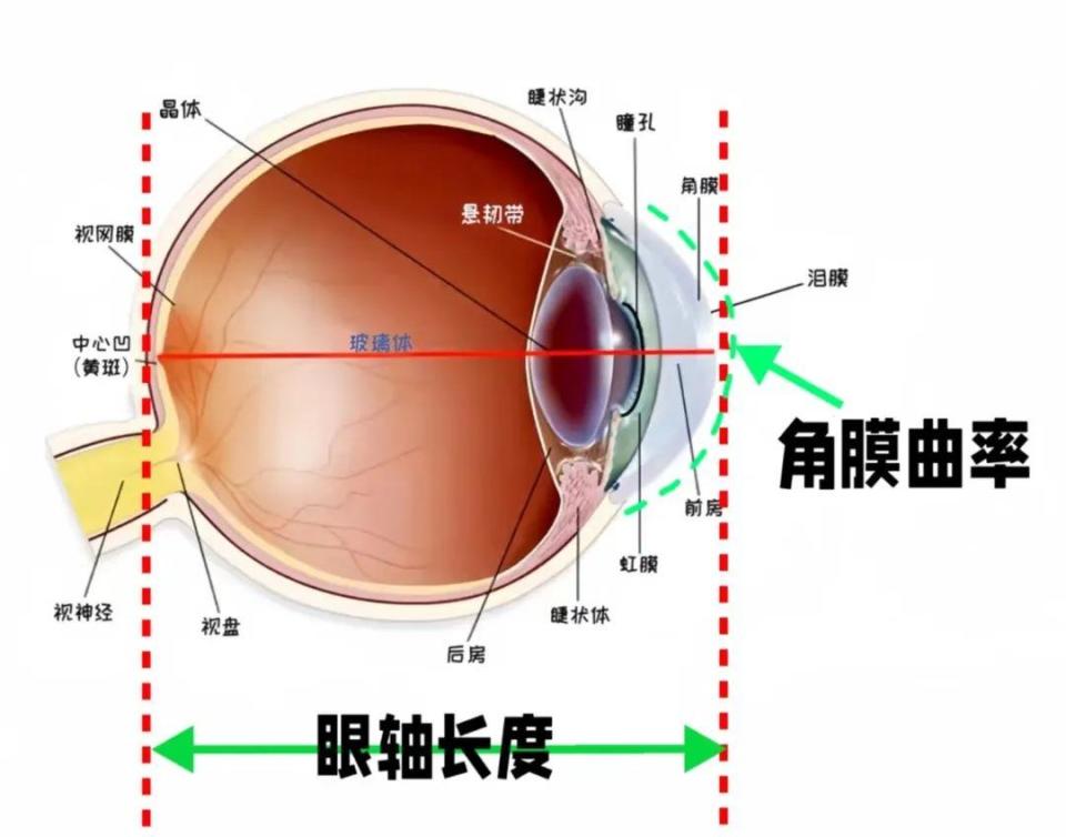 你有注意看孩子的角膜曲率吗?没想到它这么重要!