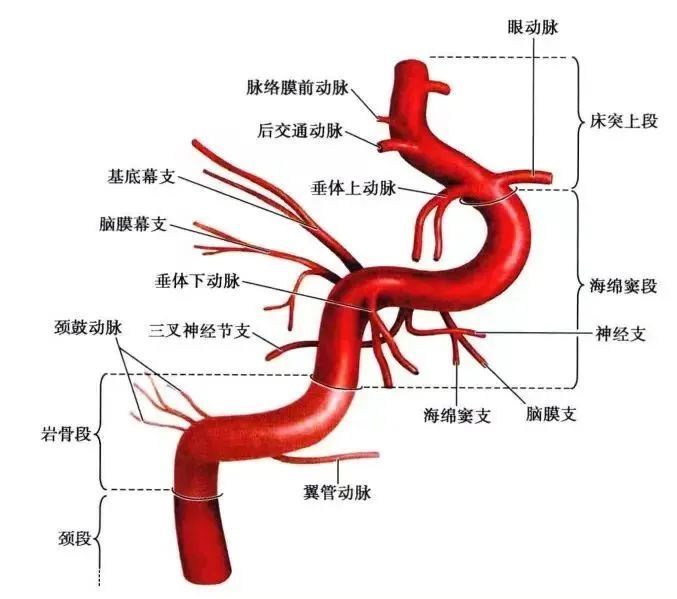 颈内动脉走行图片