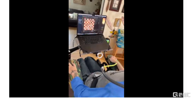 脑机接口大消息neuralink试验患者可下棋玩游戏下一代产品针对盲人