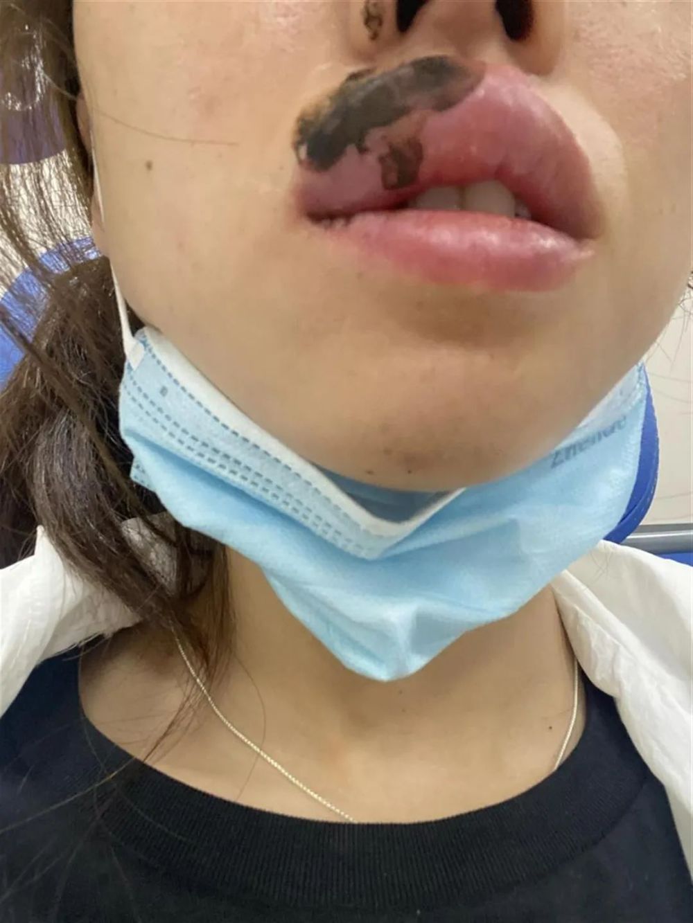 我们遇到它该怎么办?_腾讯新闻