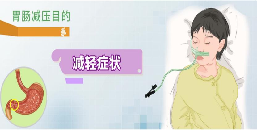 肿瘤和先天性肠道畸形引起的肠梗阻,非手术治疗无效者