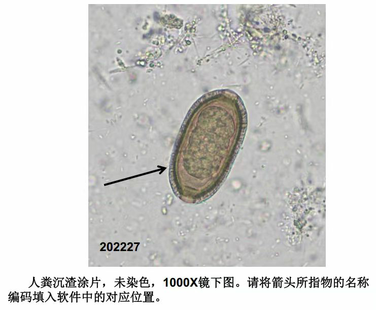 高清肝包虫图片 虫卵图片