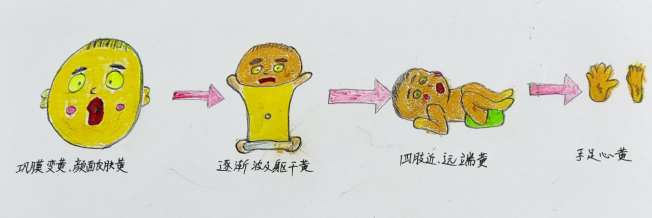 光疗时为什么黑眼罩【科普作品推荐】什么样的“光”能退黄_https://www.jmylbn.com_新闻资讯_第3张