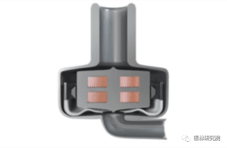 CorWave：新款脉动型LVAD人工心脏获6100万欧元融资，将进入临床试验阶段_腾讯新闻