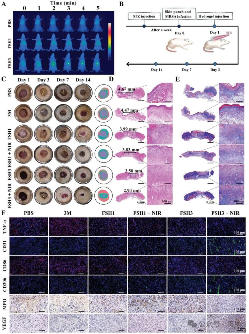 抗菌水凝胶怎么操作《Adv. Sci.》强黏附愈合紫草素水凝胶的糖尿病口腔溃疡治疗新方案！_https://www.jmylbn.com_新闻资讯_第8张